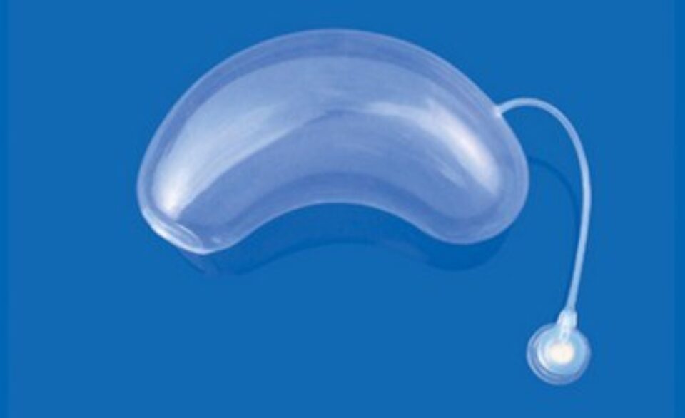 Экспандеры для детишек в Российской Детской Клинической Больнице №1 — фото 1